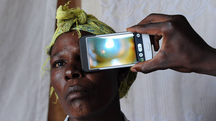 TO GO WITH AFP STORY BY IRENE WAIRIMU This photo taken on August 28, 2013, in Kianjokoma village, near Kenya's lakeside town of Naivasha, shows a technician scanning the eye of a woman with a smartphone application as she takes part in an ophthalmological study and examination, carried out by technicians from the 'Nakuru Eye Disease Cohort Study', led by Dr. Andrew Bastawrous (unseen) of the London School of Hygiene and Tropical Medicine, in which a smartphone application is used to scan people's eyes and optic nerves, to detect eye diseases, including cataracts and glaucoma. The 'Eyephone app', a smartphone application which can detect eye diseases and disorders, could potentially provide low-income and poor Kenyans with an opportunity to get a quick and effective diagnosis of their eye problems, even in remote rural areas. The equipment used in the study, which has been running for five years and is now in its final stages, is a smartphone with add-on lens that scans the retina, plus an application to record the data. The technology is deceptively simple to use and extremely cheap: each 'Eye-Phone', costs a few hundred euros (dollars), compared to a professional ophthalmoscope that costs tens of thousands of euros and weighs in at around 130 kilogrammes (290 pounds). Dr. Andrew Bastawrous of the London School of Hygiene and Tropical Medicine, who has led the study surrounding the 'Eye-Phone', hopes the 'Nakuru Eye Disease Cohort Study', which has done the rounds of 5,000 Kenyan patients, will one day revolutionalise access to eye treatment for millions of low income Africans who are suffering from eye disease and blindness. AFP PHOTO / TONY KARUMBA (Photo credit should read TONY KARUMBA/AFP/Getty Images)