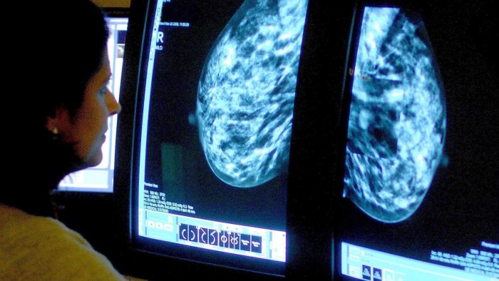 Breast cancer charity in pain plea...File photo dated 15/06/06 of a consultant analyzing a mammogram, as thousands of patients diagnosed with secondary breast cancer may be needlessly suffering from debilitating physical pain, according to a leading charity.