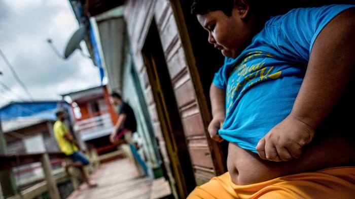Yan Correa Carneiro, a 10-year-old student who weighs 81,5 kg, dresses his t-shirt up, while sitting in front of his house in Careiro da Várzea city (in Amazonas state, Northern Brazil), on January 10th, 2018. He likes gaming and soft drinks. Although Yan is overweight, his glucose, cholesterol and triglyceride levels are within normal range. Yan also doesn't suffer from cardiovascular problems. Children obesity has already been considered pandemic. The condition affects children's development. Photo: FINANCIAL TIMES / RAPHAEL ALVES