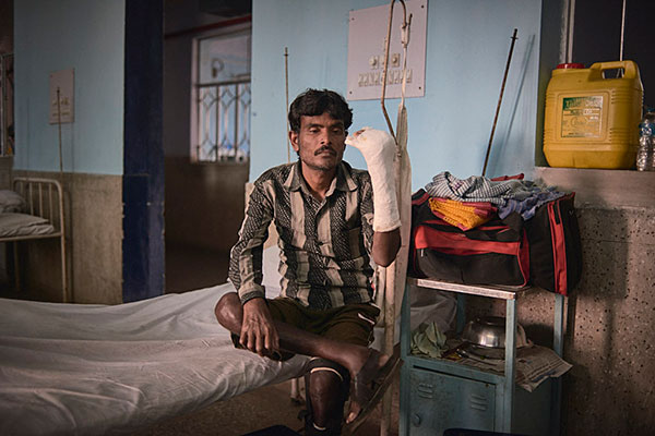 A patient being treated for leprosy in hospital in West Bengal, India