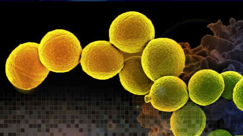 Yellow superbug bacteria imaged developed by Carb-X.