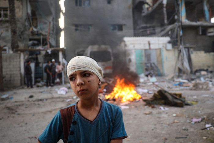 A wounded Palestinian boy stands next to a damaged home in Rafah