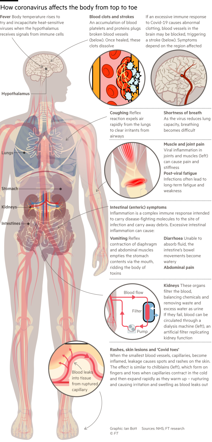 Information graphic showing some of the effects the coronavirus has on the human body